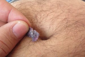 picking lint out of a belly button